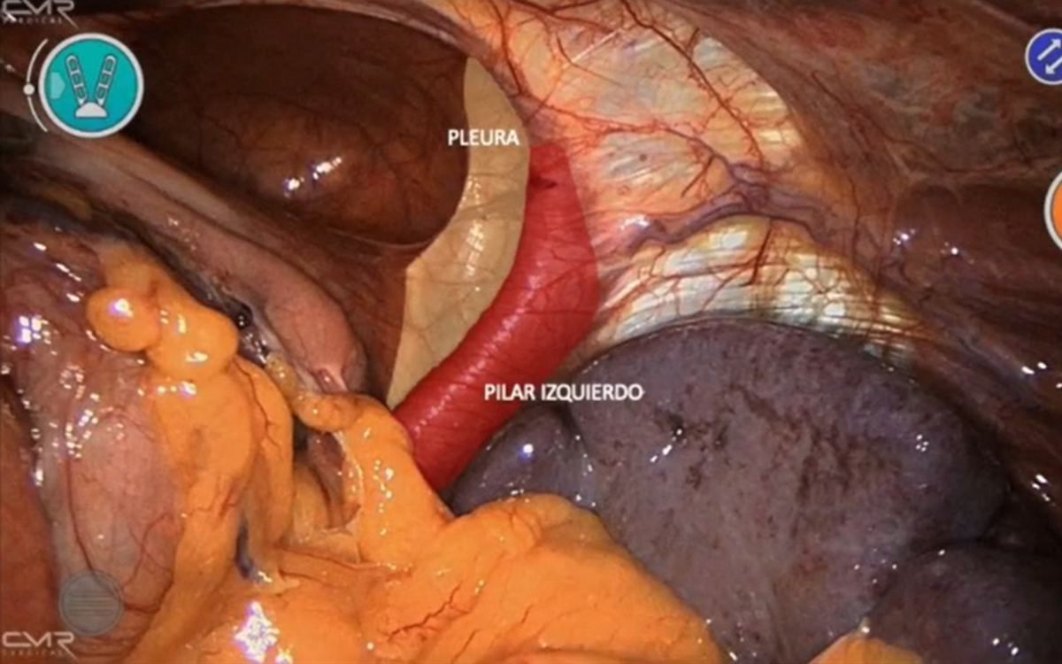 Video científico publicado por la Revista Cirugía del Uruguay