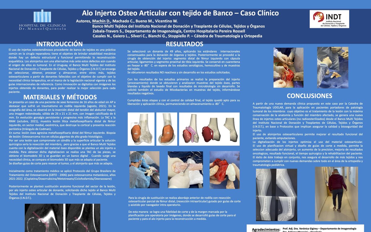 Alo injerto osteo articular con tejido de banco, caso clínico