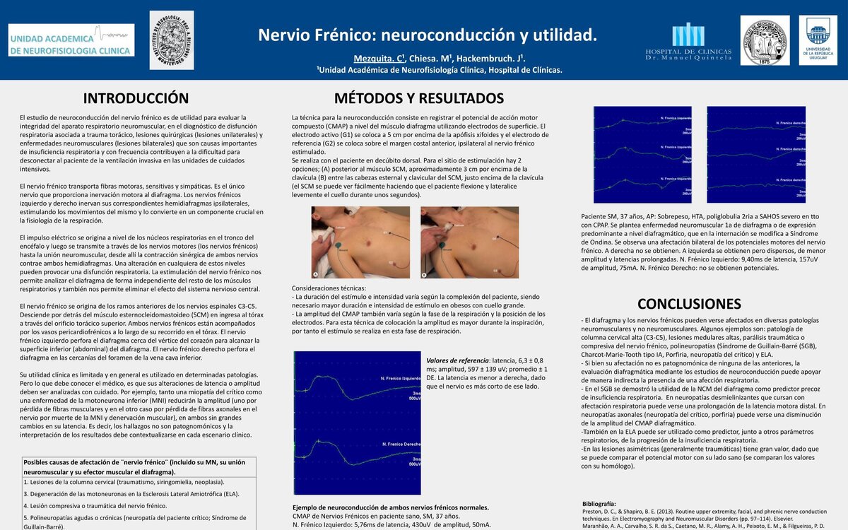 Nervio Frénico: neuroconducción y utilidad